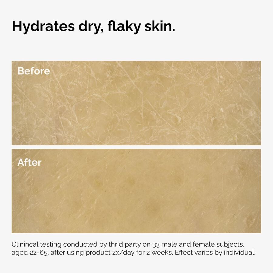 the-body-care-collection-e0 ord-natural-moisturizing-factors-inulin-body-before-after-graphic-02.jpg