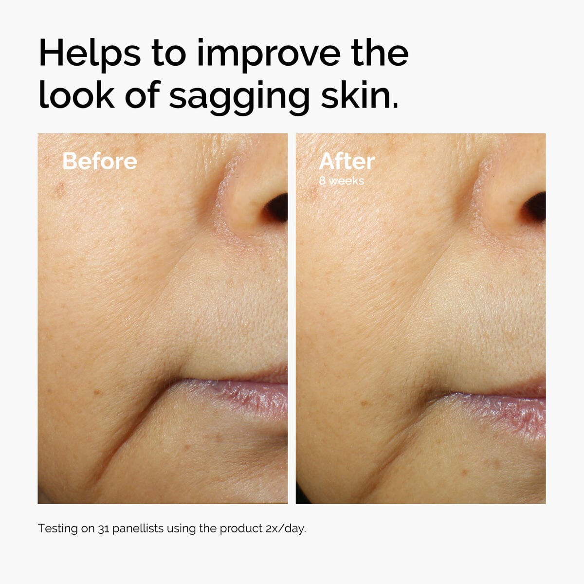 caffeine-3-escin-1-face-serum-m8 ord-caffeine-3pct-escin-1pct-face-serum-before-after-sagging.jpg