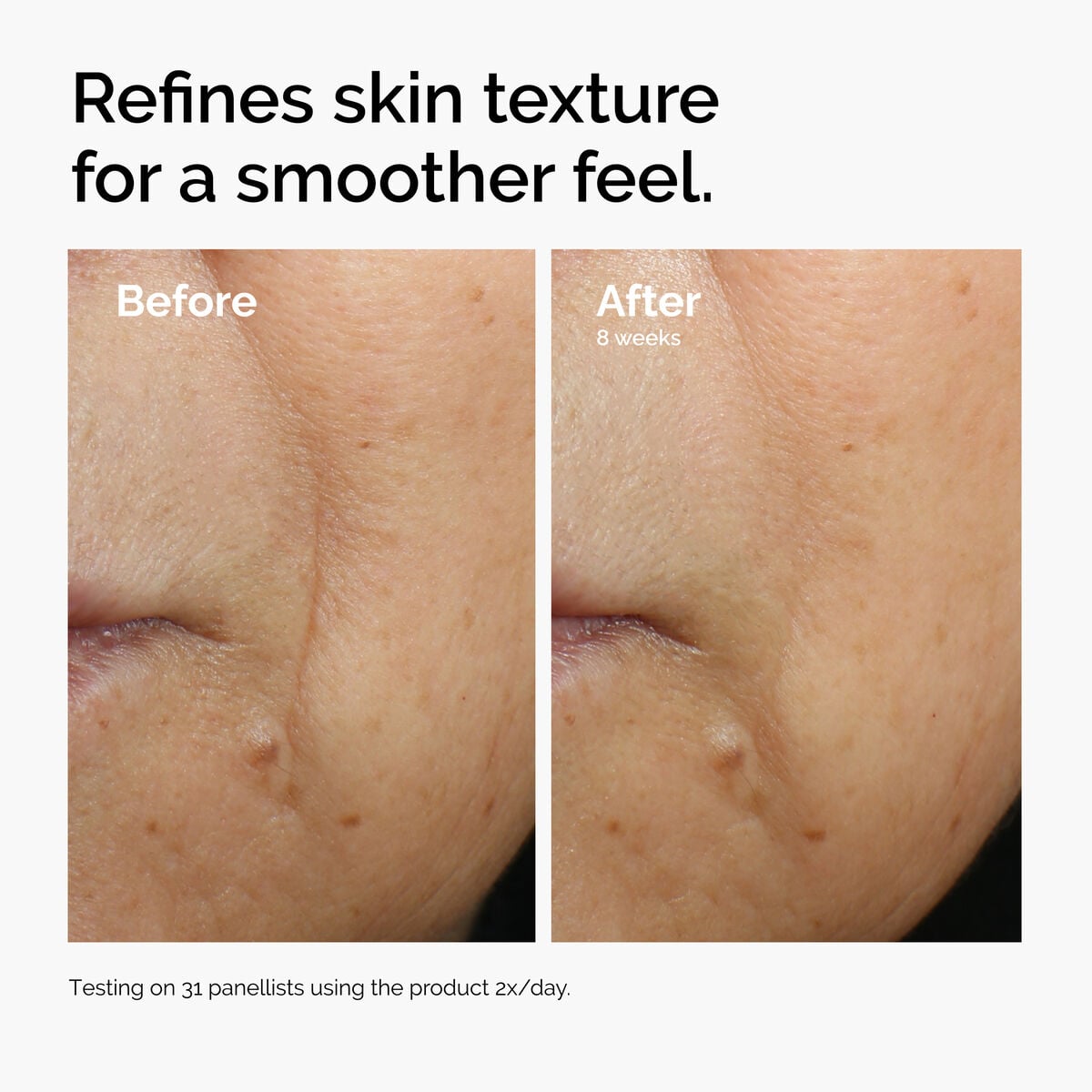 caffeine-3-escin-1-face-serum-m8 ord-caffeine-3pct-escin-1pct-face-serum-before-after-texture.jpg