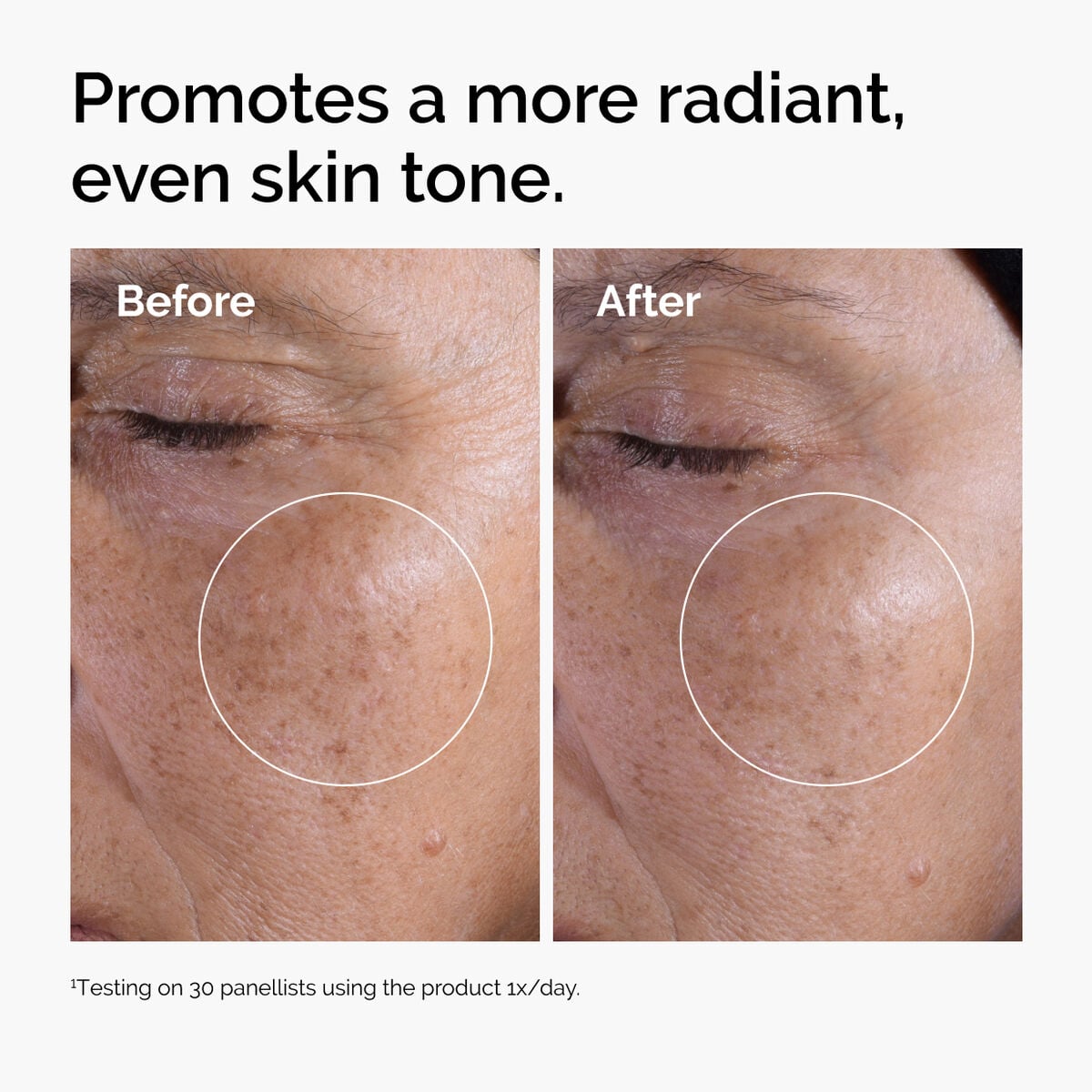 glycolic-acid-7-exfoliating-toner-d3 ord-glycolic-before-after-radiance.jpg