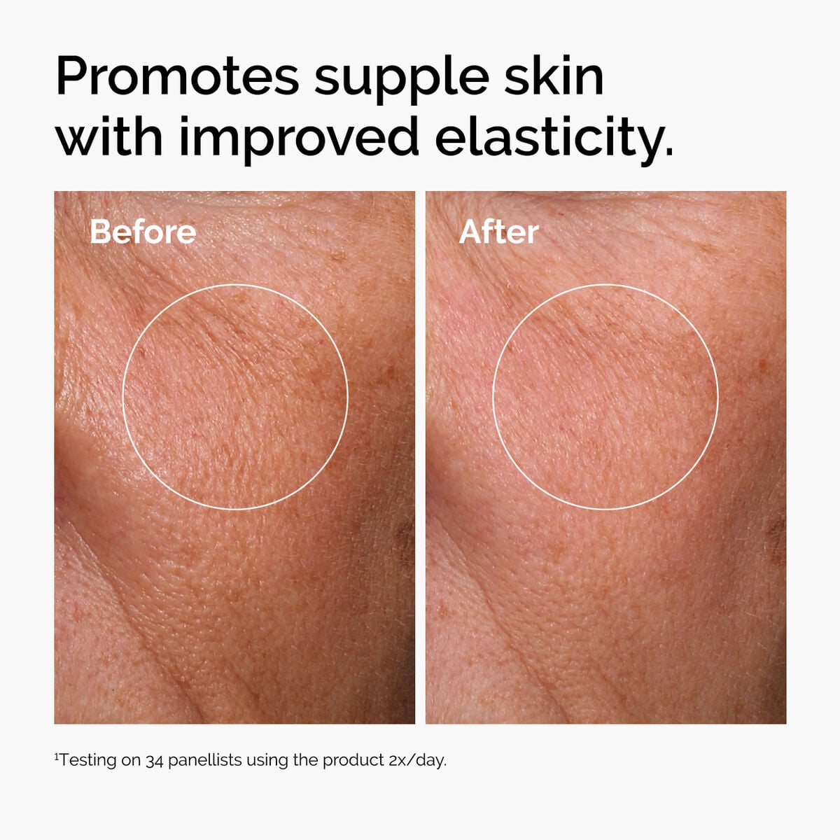 hyaluronic-acid-2-b5-with-ceramides-n0 ord-hyaluronic-acid-2pct-b5-hydrating-serum-before-after-elasticity.jpg