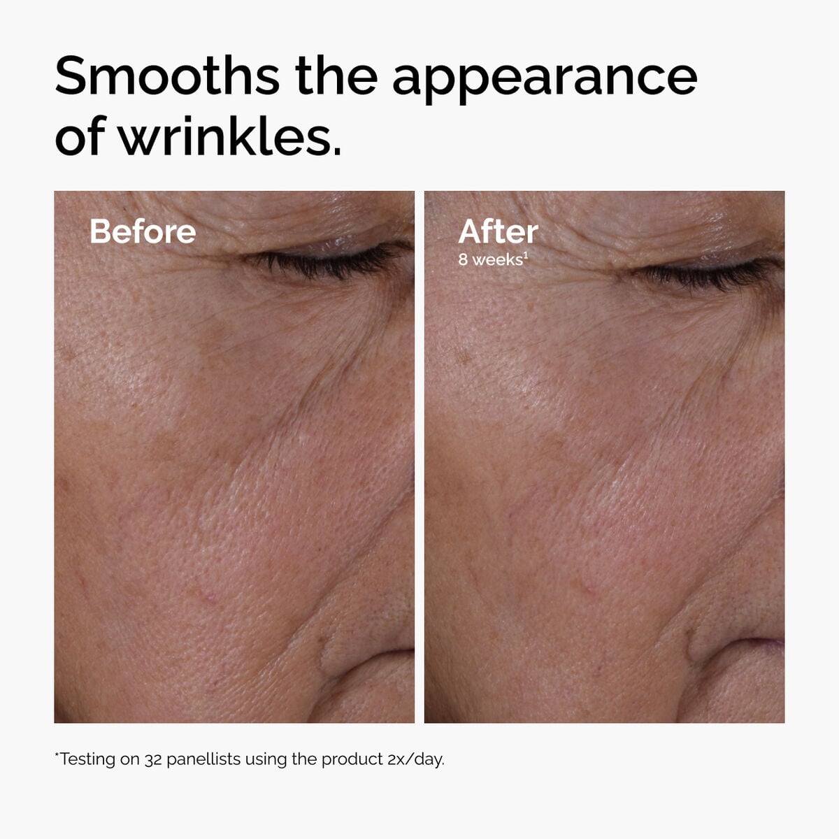 multi-peptide-ha-serum-s8 ord-multi-peptide-ha-serum-wrinkles-before-after.jpg