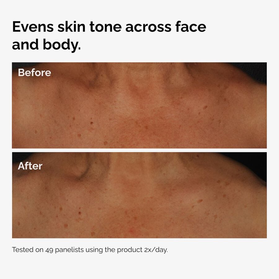 the-body-care-collection-e0 ord-niacinamide-face-body-serum-before-after-even-tone-graphic.jpg