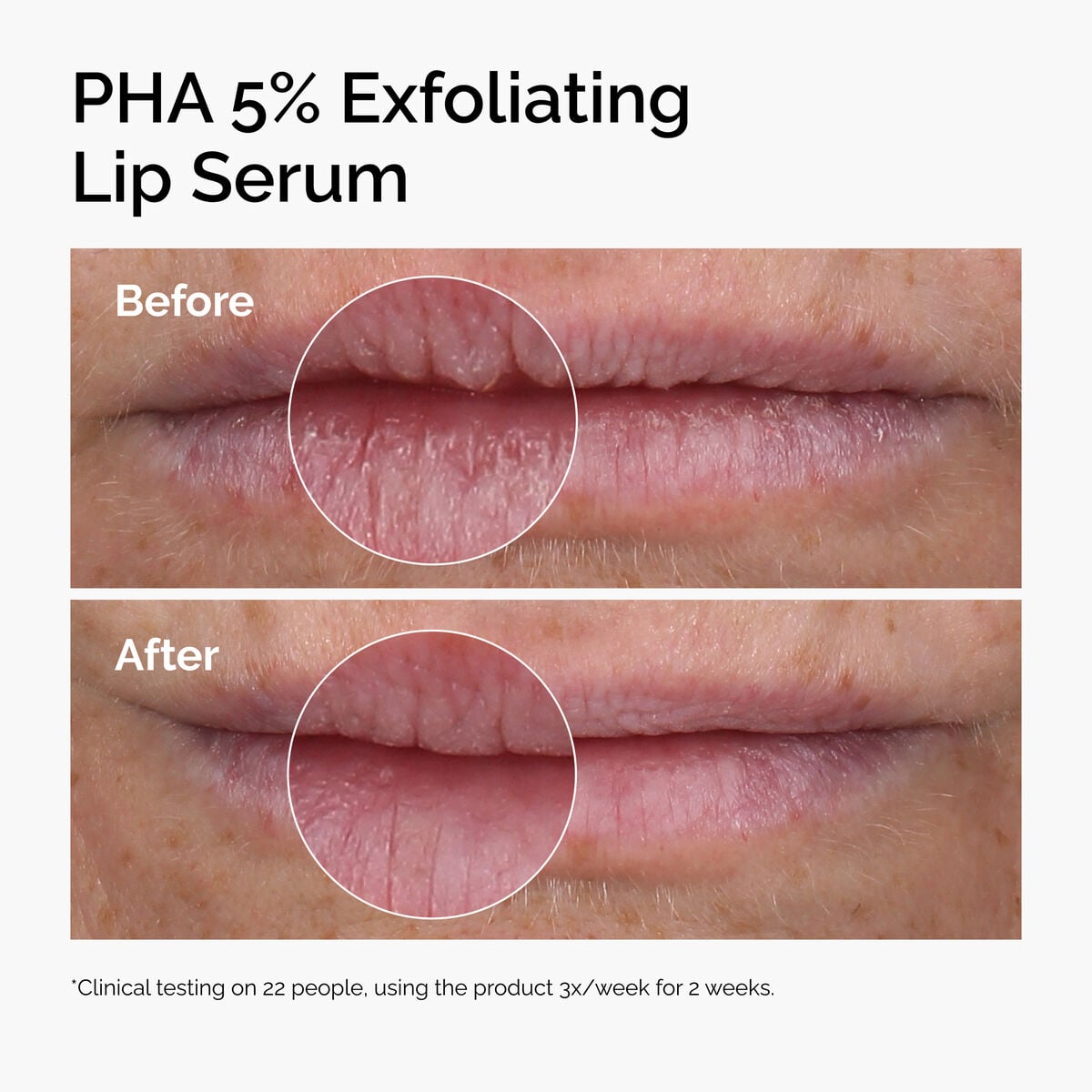 pha-5-exfoliating-lip-serum-y3 ord-pha-5pct-lip-exfoliating-serum-before-after.jpg