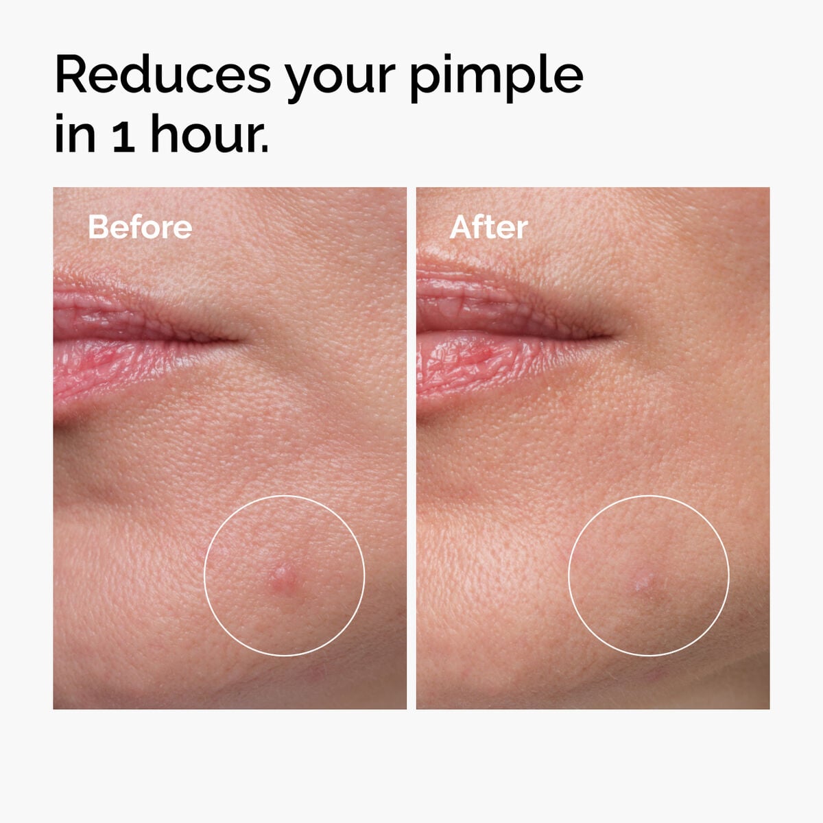 sulfur-10-powder-to-cream-concentrate-n3 ord-sulfur-10pct-powder-to-cream-concentrate-before-after-NA.jpg